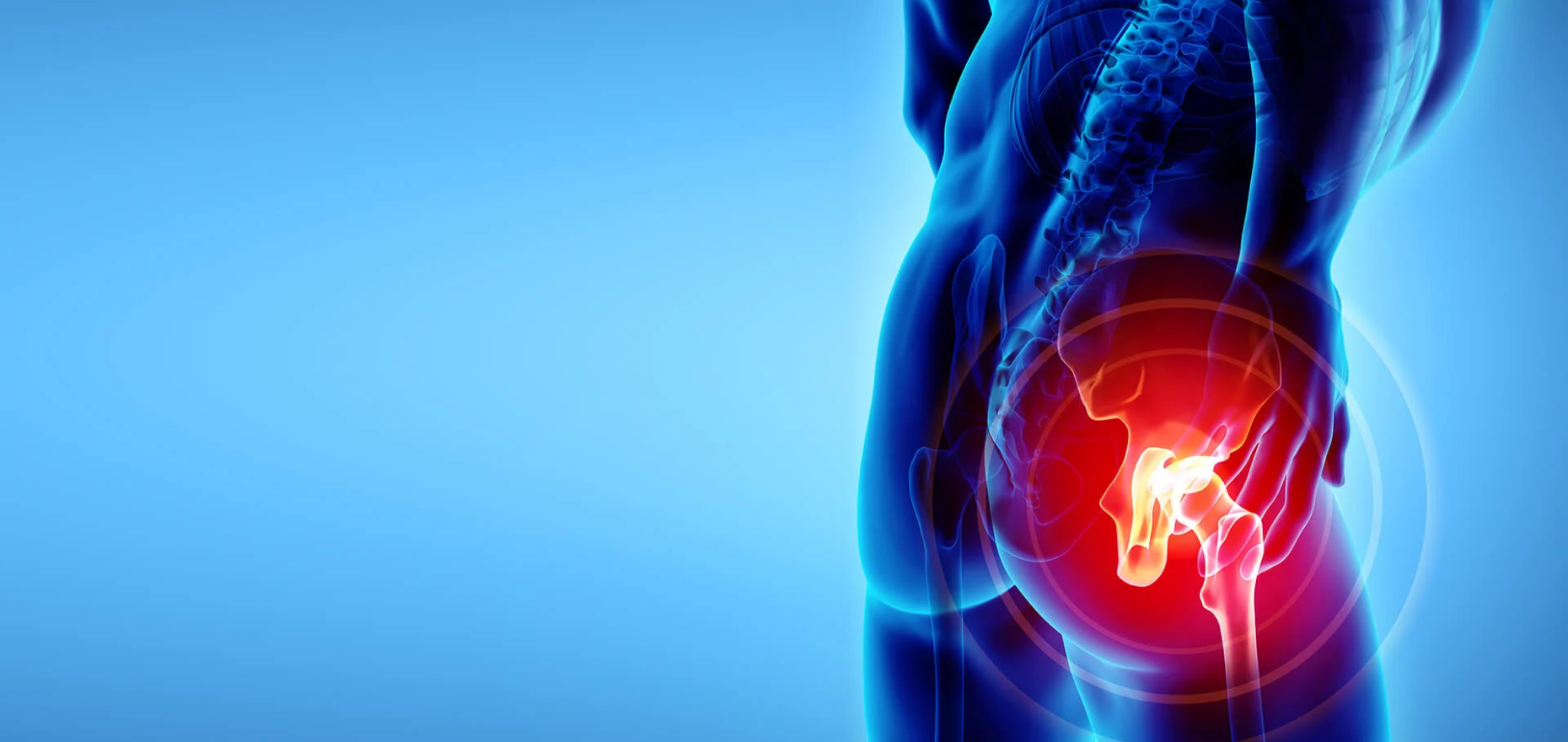 Saksham Ayurveda - Ayurvedic Treatment for AVN (Avascular Necrosis)